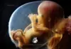 Новая проактивная идея родилась после 8 Марта SAVE_A_LIVE_RU_fetus_week_16