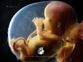 SAVE_A_LIVE_RU_fetus_week_16